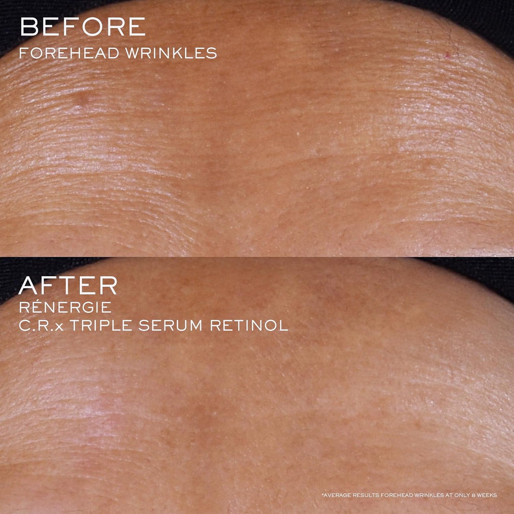 Lancôme Rénergie C.R.X. Triple Serum Retinol Skin Resurfacing Serum