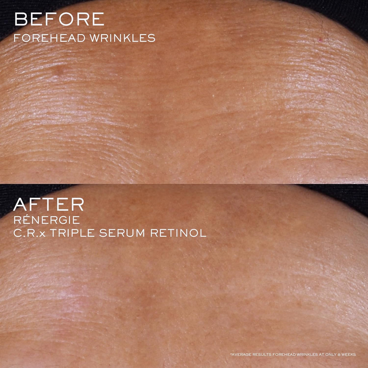 Lancôme Rénergie C.R.X. Triple Serum Retinol Skin Resurfacing Serum